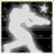 Supersoldat